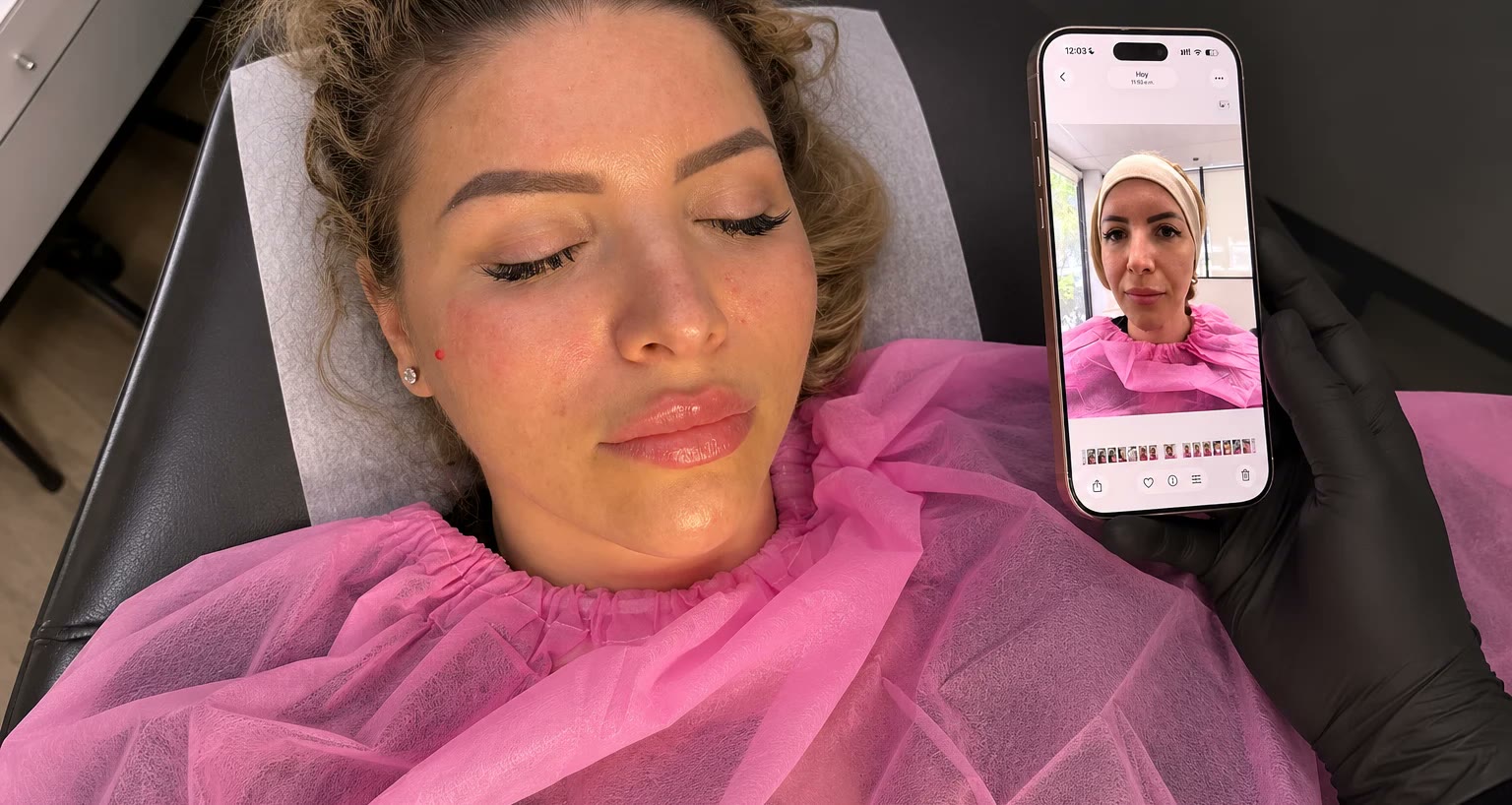 Resultado de estética facial