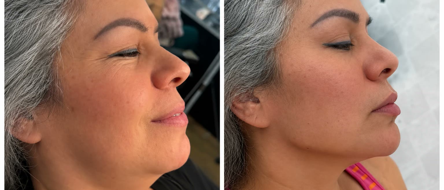 Resultado de perfil facial